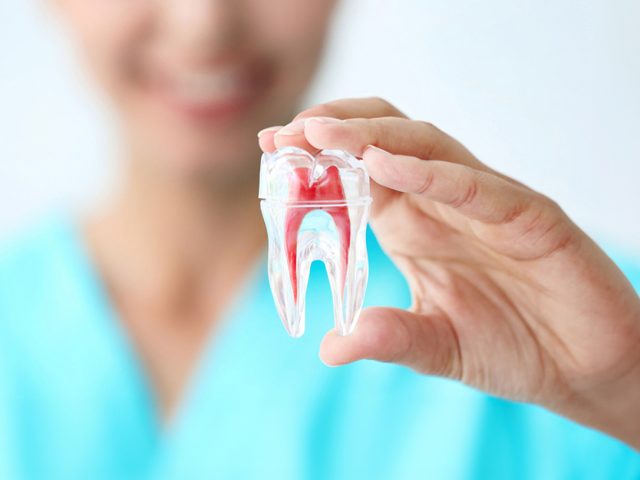 Le traitement endodontique Antibes